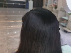 -碧莲盛·不剃发植发