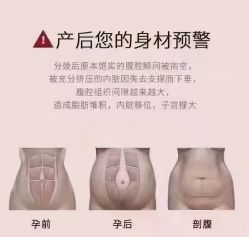 点击看大图 -昕孕瑜伽·孕妇瑜伽·产后修复