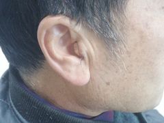 -自然之声助听器·呼吸机(贵定店)