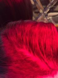 -碧莲盛·不剃发植发