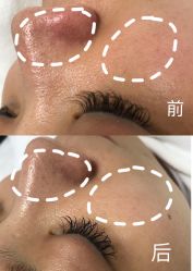 -凡碧诗毛孔收细