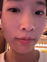 -紫洁俪方（北京）医疗美容