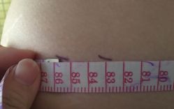 -肥三针腧穴瘦身馆