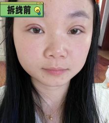 -素美医疗美容·西南眼鼻整形·修复基地