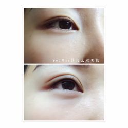 点击看大图 -YooMee优美智能科技美肤机构