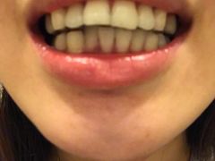 -浙江大学医学院附属口腔医院湖滨（延安）院区