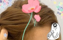 -大麦微针植发全国连锁