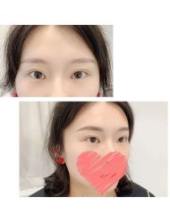 -MIVI半永久纹眉绣眉