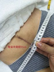 -百佳医疗级月子会所