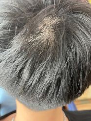 -极客侠男士假发定制补发