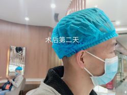 点击看大图 体验后-新生植发·植养护一体