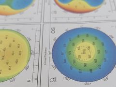 -武汉大学附属爱尔眼科医院(湖北总院)
