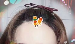 -大麦微针植发全国连锁