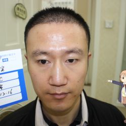 -大麦微针植发丨全国连锁