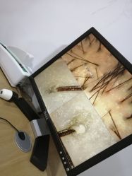 -章光101防脱养发荟