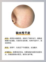 -克丽缇娜
