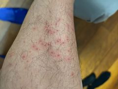 -华夏良子·足道SPA艾灸(龙潭路店)