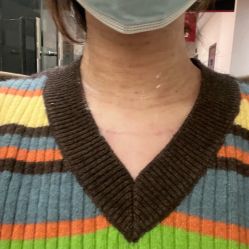 体验后-上海玫瑰医疗美容医院