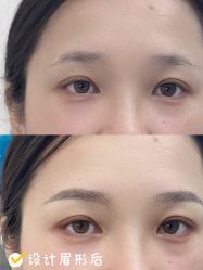 -久匠·纹眉纹绣半永久