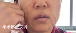 -广州美莱医疗美容医院