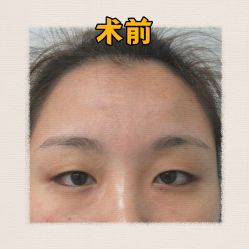 -素美医疗美容·西南眼鼻整形·修复基地