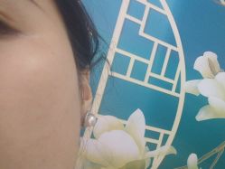 -美安心医美·美迪迈黄金微针·美拉美医疗美容