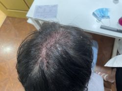点击看大图 -熙朵美学植发连锁