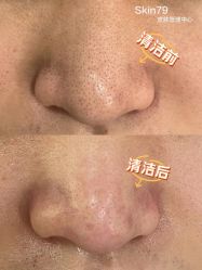 -SKIN79皮肤管理中心