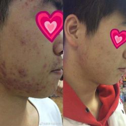 -康美贞·痘肌养护管理中心