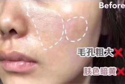 -正璞医疗美容·皮肤修复·微整注射