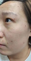 -北京美痣堂古方祛痣斑疣瘊