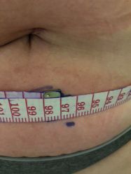 -肥三针腧穴瘦身馆