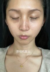 -恒妍医美·韩国定制抗衰中心