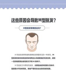 点击看大图 -极客侠男士假发定制补发