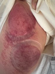 -佳医堂·小儿推拿·产后康复·脊柱养护(新华联家园店)