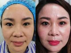 点击看大图 -西安现代妇产医院医疗美容