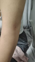 -北京美痣堂古方祛痣斑疣瘊
