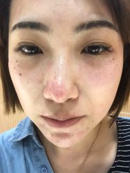 -上海玫瑰医疗美容医院