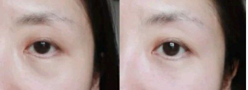 -蕾特恩专业祛痘·皮肤管理