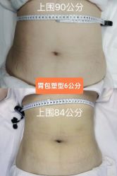 -Lily纤美·科技减脂中心