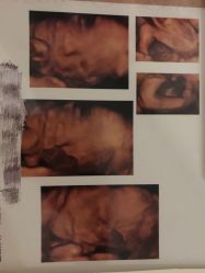 -郑州万安妇产医院