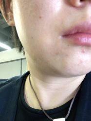 -深圳鹏爱悦心医疗美容医院