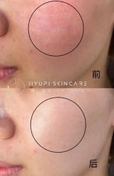 点击看大图 -MLP美丽派·问题肌疗愈中心