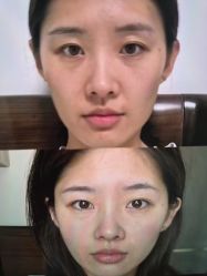 -长沙雅美医疗美容医院