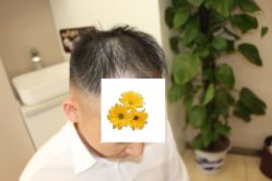 -大麦微针植发丨全国连锁
