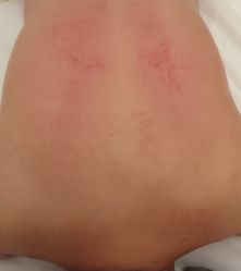 -苑苑vbeauty科技美容SPA
