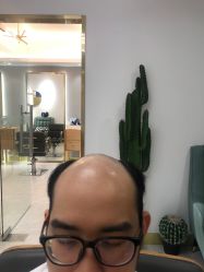 -发饰美男士增发补发假发定制店