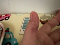 -广州市红十字会医院(总院)