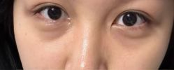 -广州美莱医疗美容医院