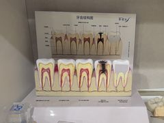 -上海仁爱医院口腔科 · 种植